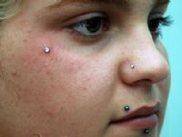 PIERCING MICRODERMAL EN ROSTRO